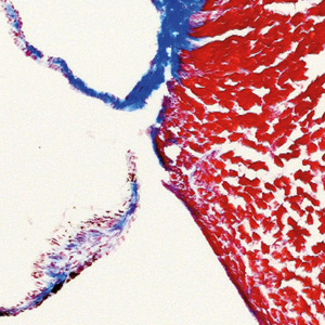 Ausstellung - Blick ins Herz